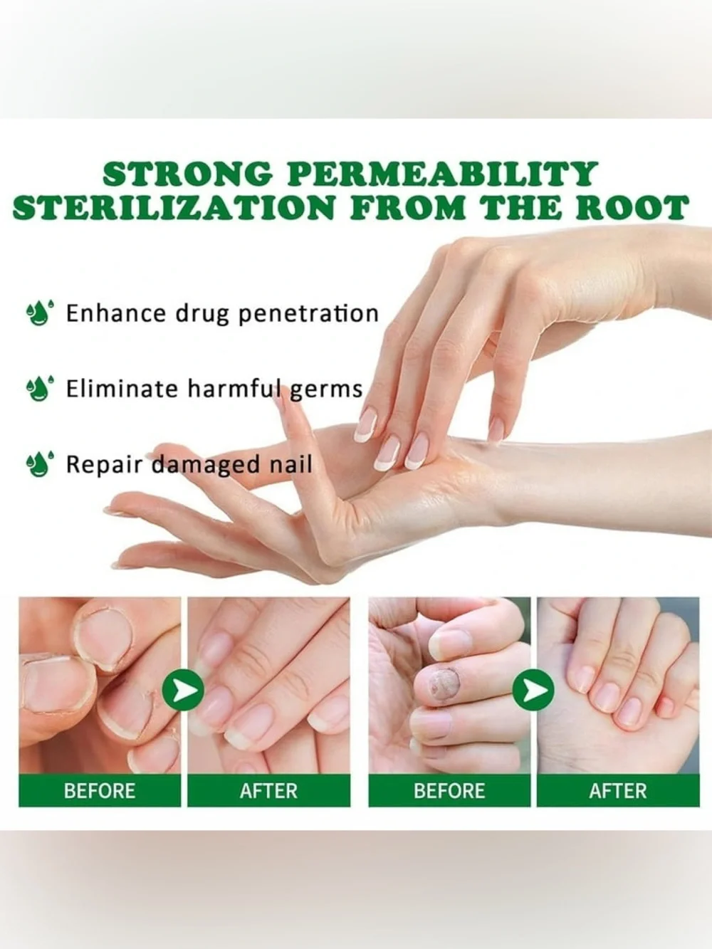 Jaysuing 7Days Nail‎ Fungus Treatment NEW/SEALED